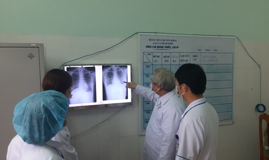 Bệnh nhân quê Quảng Trị trở về từ vùng dịch bị sốt chụp viêm phổi không có tổn thương. Ảnh: XH.