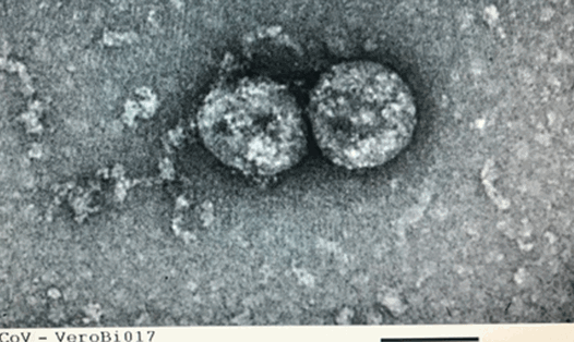 Virus SARS-CoV-2 do Việt Nam nuôi cấy và phân lập trong phòng thí nghiệm. Ảnh: Viện Vệ sinh dịch tễ Trung ương