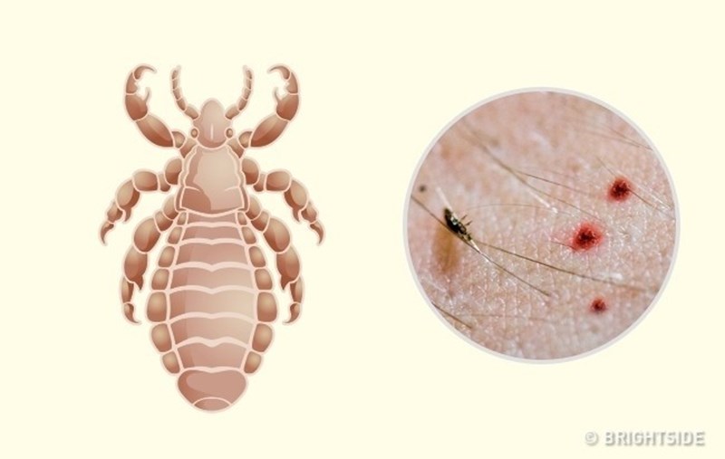 Côn trùng cắn - Côn trùng có thể là mối đe dọa đối với sức khỏe của chúng ta và gia đình. Tuy nhiên, hãy xem hình ảnh để hiểu rõ hơn về cách phòng tránh côn trùng và sức khỏe của bạn sẽ được bảo vệ hoàn toàn.