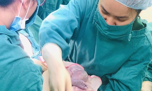 Các bác sĩ Trung tâm Sản Nhi (Bệnh viện Đa khoa tỉnh Phú Thọ) thực hiện lấy thai cho sản phụ.
