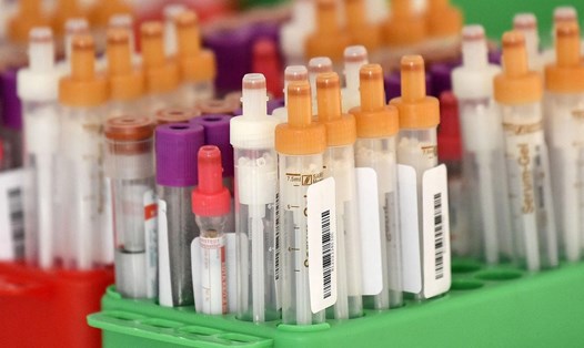 Các mẫu xét nghiệm kháng thể COVID-19 tại một trung tâm y tế ở Đức. Ảnh: AFP.