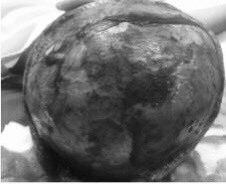 Ảnh: Bệnh viện cung cấp