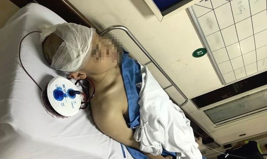 L.T.K đang được điều trị tại Bệnh viện Việt Đức. Ảnh: GĐCC