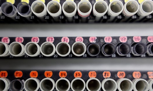 Hình ảnh các mẫu ống nghiệm đựng các mẫu để sàng lọc COVID-19 tại Levallois-Perret, gần Paris, Pháp. Ảnh: AFP.