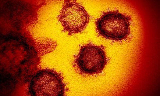 Virus SARS-CoV-2 đột biến gây bất lợi cho nghiên cứu vaccine COVID-19. Ảnh: AP.