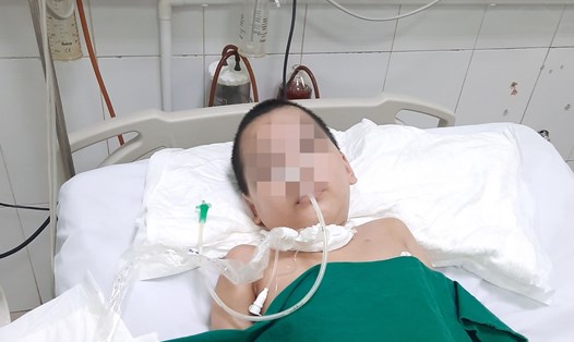 Bé Phạm Anh Huy đang được điều trị tích cực tại Bệnh viện Y học Cổ truyền tỉnh Yên Bái. Ảnh: GĐCC