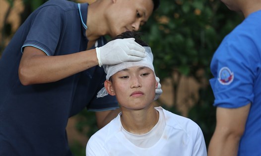 Cầu thủ U19 nữ Việt Nam Trần Hải Linh bị rách trán trong ngày khai mạc. Ảnh: Đông Đông