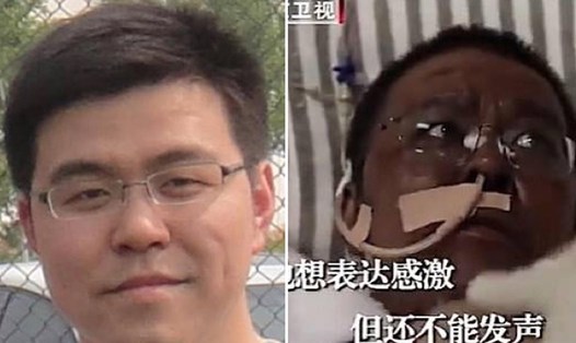 Bác sĩ Hu Weifeng trước và sau khi mắc COVID-19. Ảnh: Pear Video/Beijing TV