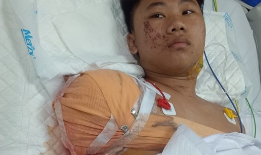 Nguyễn Quốc Duy vẫn chưa hết bị sốc trước những mất mát quá đau đớn sau vụ tai nạn. 
Ảnh: GĐCC