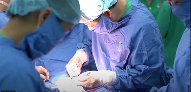 GS Nguyễn Viết Tiến thực hiện ca phẫu thuật. Ảnh: BSCC