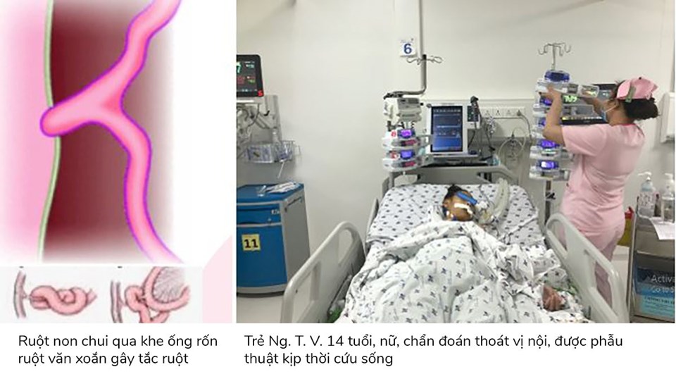 Hình ảnh do bệnh viện cung cấp. Hình ảnh do bệnh viện cung cấp.