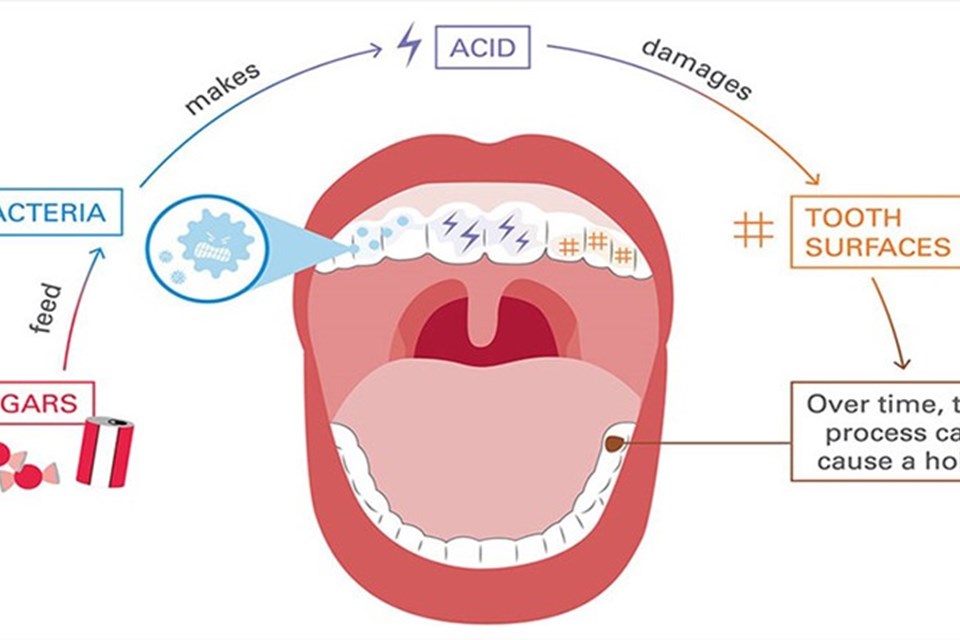 Nên khám định kỳ răng mỗi 6 tháng Nên khám định kỳ răng mỗi 6 tháng