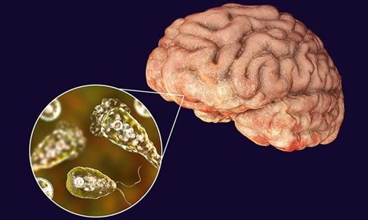 Ký sinh trùng ăn não người xâm nhập vào cơ thể qua đường mũi, lên não và phá hủy mô não. Ảnh: Genesis