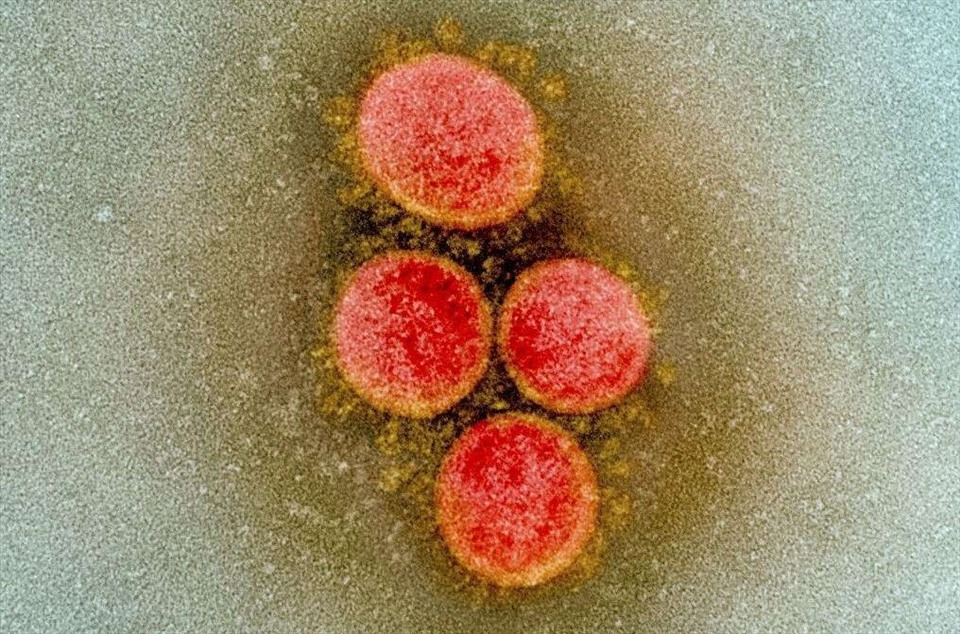 Ảnh SARS-CoV-2 qua kính hiển vi. Ảnh: AFP.