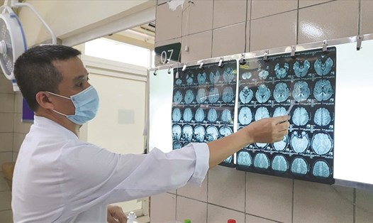 TS.BS Nguyễn Trung Nguyên - Giám đốc Trung tâm Chống độc (Bệnh viện Bạch Mai) xem phim cộng hưởng từ chụp sọ não người bệnh. Ảnh H.L