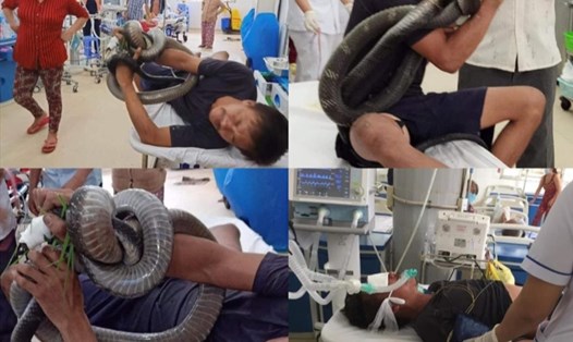 Người đàn ông ở Tây Ninh mang con rắn cắn mình tới bệnh viện. Ảnh: Người dân cung cấp