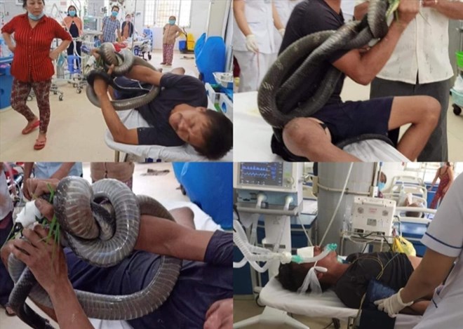 Man brings whole cobra that bit him to hospital