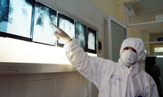 Bác sĩ điều trị bên những tấm phim chụp Xquang phổi của bệnh nhân COVID-19. Ảnh: Bộ Y tế cung cấp