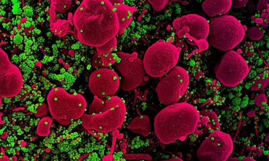 Ảnh vi điện tử của một tế bào (màu hồng) bị nhiễm nặng các hạt virus SARS-CoV-2 (màu xanh lá cây), được phân lập từ mẫu bệnh nhân. Ảnh: NIAID/AFP