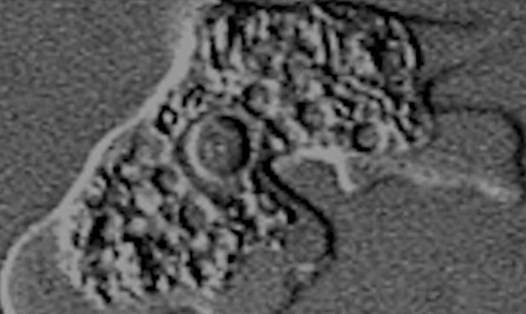 Naegleria fowleri - một loại amip ăn não hiếm gặp - được tìm thấy trong nguồn nước ở 8 thành phố thuộc bang Texas, Mỹ. Ảnh: CNN
