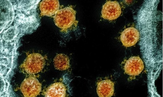 Các nhà nghiên cứu Mỹ cảnh báo về hệ quả của virus SARS-CoV-2 biến chủng với phát triển vaccine. Ảnh: AP.