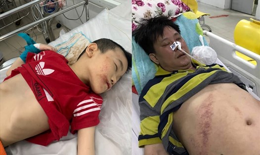 Cả chồng và con trai thứ ba của chị Nguyễn Thị Thanh Thảo đều đang phải điều trị tích cực. Ảnh: GĐCC