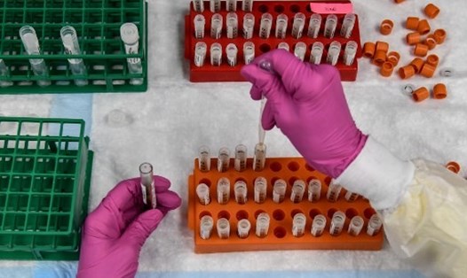 Kỹ thuật viên phòng thí nghiệm sắp xếp các mẫu máu cho một nghiên cứu tiêm vaccine COVID-19 tại Trung tâm Nghiên cứu Mỹ ở Hollywood, Florida. Ảnh: AFP.