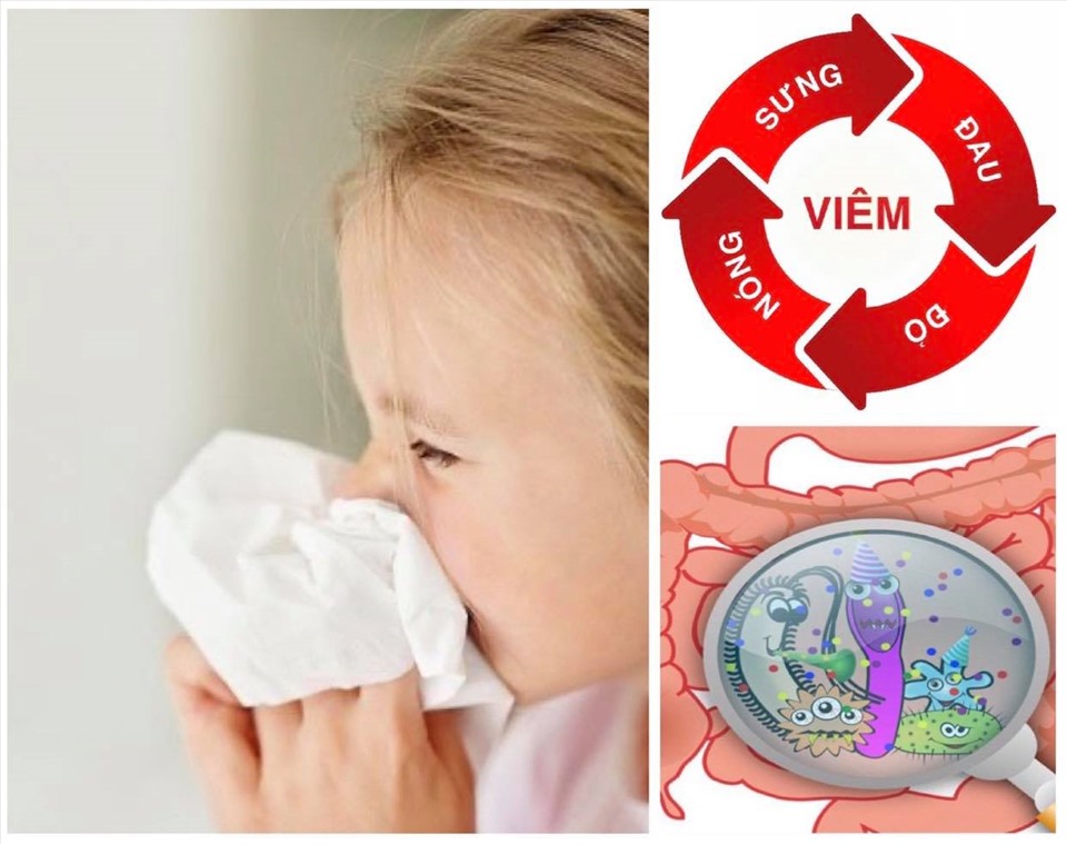 Mùa đông trẻ em dễ mắc các bệnh viêm đường hô hấp, viêm dạ dày ruột. Đồ họa: Hương Giang