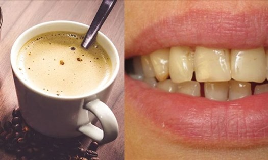 Cà phê có thể khiến răng ố vàng. Đồ họa: VA