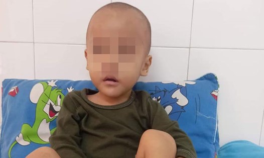 Bé Nguyễn Văn Nhân, 3 tuổi, quê xã Duy Hòa, huyện Duy Xuyên, tỉnh Quảng Nam vừa phát hiện bị ung thư máu. Ảnh: Uy Tích
