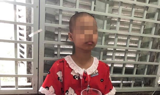 Căn bệnh ung thư khiến bé Huỳnh Thị Kiều Diễm (13 tuổi) phải ngủ trong tư thế ngồi khom người nhiều năm nay. Ảnh: GĐCC