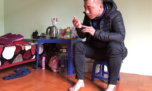 Anh Đàm Đình Văn - công nhân Khu Công nghiệp Yên Phong, tỉnh Bắc Ninh - bị thương tích, phải tạm nghỉ làm sau vụ tai nạn giao thông vào thời điểm tháng 12.2020 Ảnh: Bảo Hân