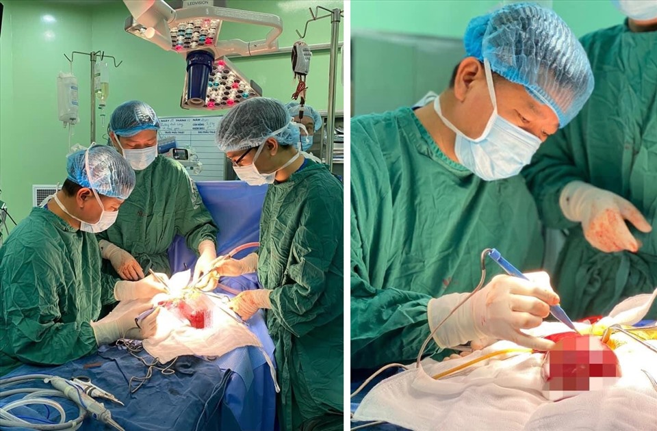 Các bác sĩ Bệnh viện Nhi Trung ương thực hiện ca phẫu thuật cho cháu bé. Ảnh: BVCC