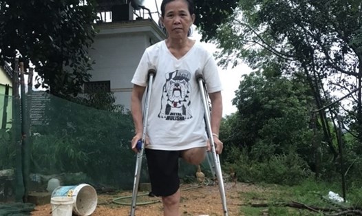 Bà Nguyễn Thị Tuyết bị cụt chân do tai nạn lao động. Ảnh: Phạm Thông