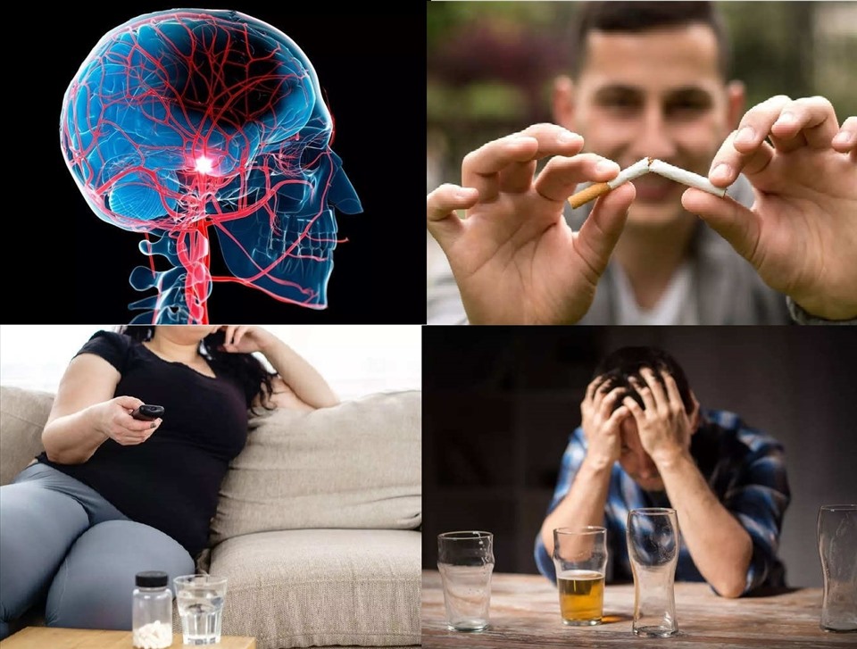 Những thói quen trong lối sống có thể làm tăng nguy cơ đột quỵ. Ảnh minh họa: Nhật Quang