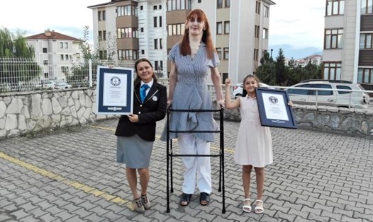 Rumeysa Gelgi lập kỷ lục là người phụ nữ cao nhất thế giới còn sống. Ảnh: Kỷ lục Guinness Thế giới