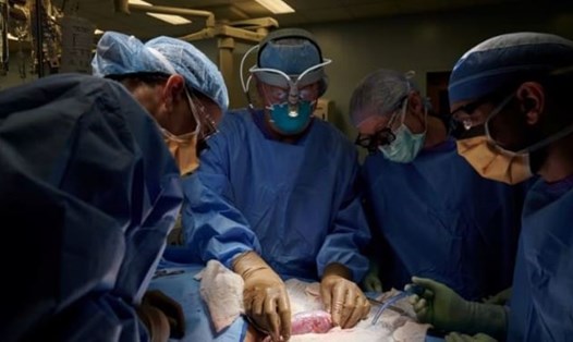 Nhóm bác sĩ phẫu thuật kiểm tra dấu hiệu đào thải ca cấy ghép thận lợn cho người ở NYU Langone Health, New York, Mỹ. Ảnh: NYU Langone Health