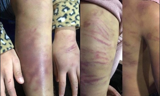 Người mẹ hành hạ con gái ở quận Hà Đông, Hà Nội bị pháp luật xử lý, truy tố ra trước toà. Ảnh: LĐO