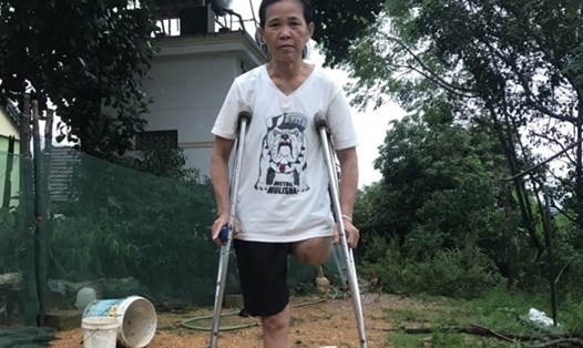 Bà Nguyễn Thị Tuyết (55 tuổi) trú xã Thanh Xuân, huyện Thanh Chương tỉnh Nghệ An bị mất chân do tai nạn lao động. Ảnh: Phạm Thông