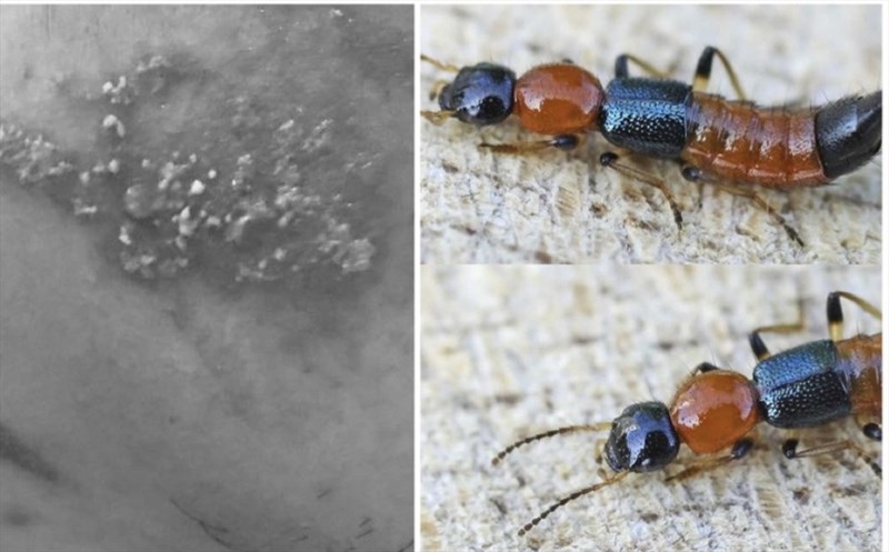 Làm thế nào để nhận biết kiến ba khoang cắn và phân biệt với các loại côn trùng khác?
