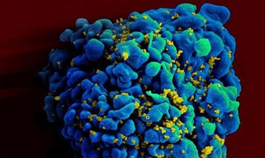 Bệnh nhân HIV thứ 2 trên thế giới được xác định tự khỏi, không cần điều trị. Ảnh: NIAID