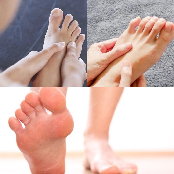 Dấu hiệu bất thường ở bàn chân cảnh báo vấn đề sức khỏe