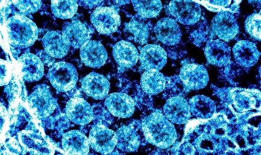Virus SARS-CoV-2. Ảnh: Viện Dị ứng và Bệnh truyền nhiễm Quốc gia Mỹ