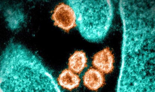 Hình ảnh từ kính hiển vi điện tử cho thấy virus SARS-CoV-2 xuất hiện từ bề mặt của tế bào được nuôi cấy trong phòng thí nghiệm. Ảnh: National Institute of Allergy and Infectious Diseases via AFP