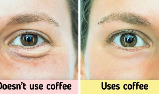 Tác dụng bất ngờ của cà phê làm giảm quầng thâm mắt. Ảnh: Brightside