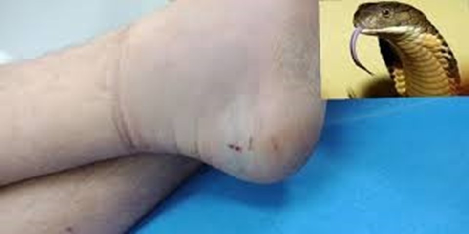 Điều trị rắn cắn bằng huyết thanh kháng nọc đặc hiệu. Ảnh minh hoạ Điều trị rắn cắn bằng huyết thanh kháng nọc đặc hiệu. Ảnh minh hoạ