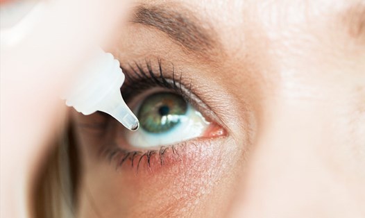 Sử dụng thuốc nhỏ mắt quá nhiều sẽ gây một hiệu ứng ngược. Ảnh: Xinhua
