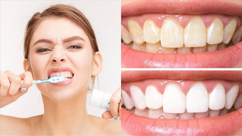 Làm thế nào để đánh răng hiệu quả trong thời gian ngắn?

