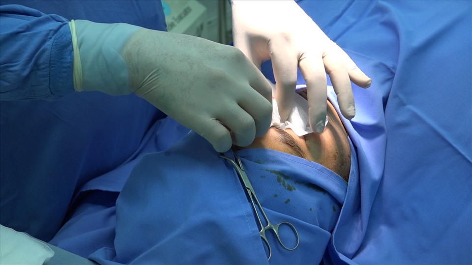 Phẫu thuật thẩm mỹ. Ảnh minh họa