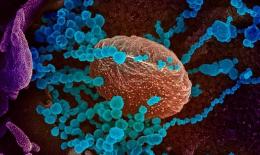 SARS-CoV-2 (vật thể tròn màu xanh lam) trên bề mặt của tế bào được nuôi cấy trong phòng thí nghiệm. Ảnh: Viện Y tế Quốc gia/AFP/Getty Images
